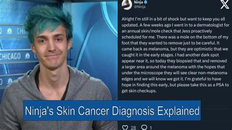 ninja twitch|does ninja actually have cancer.